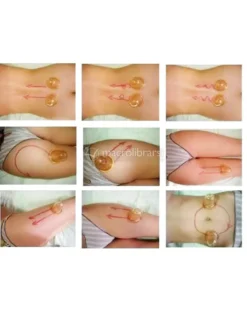 Coppetta in Silicone per il Corpo - Media