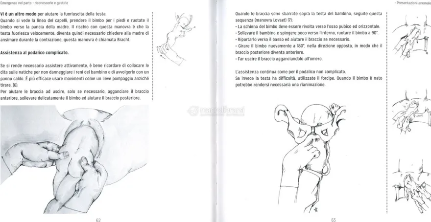 Emergenze nel Parto