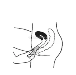 Spugna Mestruale - Taglia XS