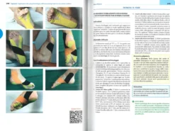 Taping Kinesiologico nella Traumatologia Sportiva Moderna