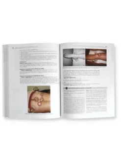 Terapia di Coppettazione in Medicina Tradizionale Cinese